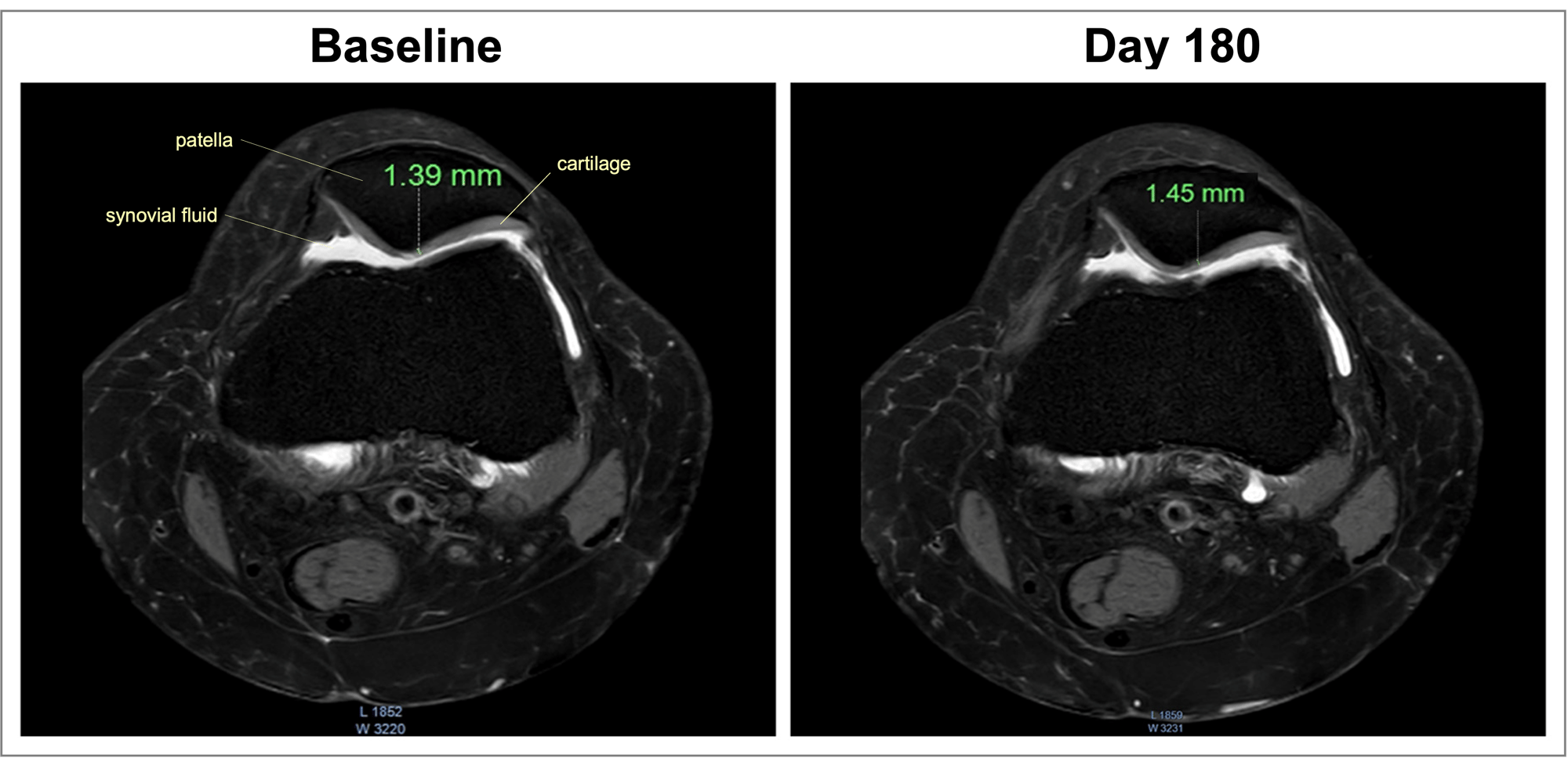 MRI-Apresflex-img-1